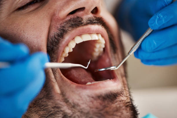 Best Emergency TMJ Treatment in Summit, MS